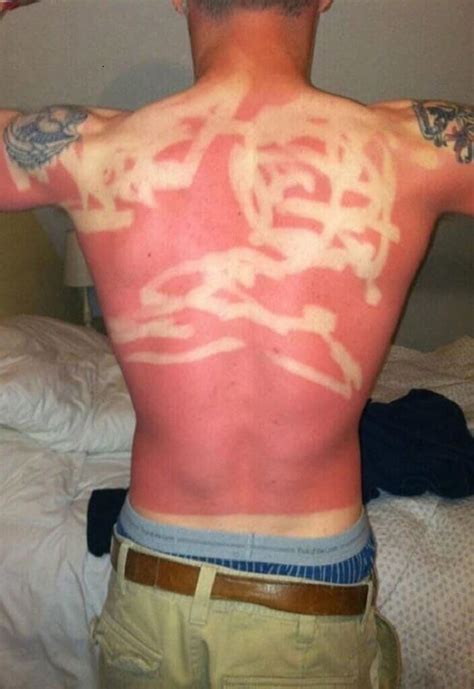 30 Epic Tanning Fails Thatll Have You Saying Pass The Sunscreen