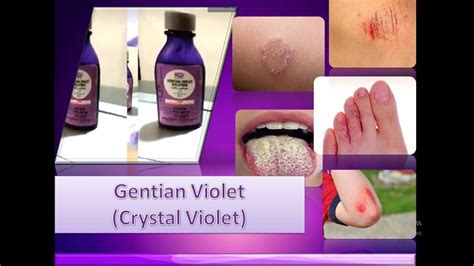 Gentian Violet Crystal Violet Treatment For Candida Albicans Youtube