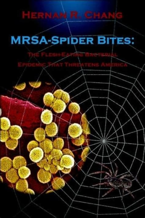 Mrsa Spider Bites Hernan R Chang 9781847281647 Boeken