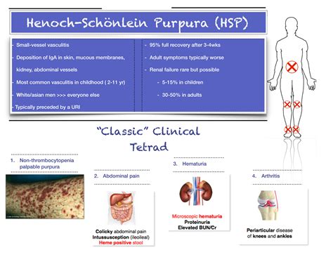 Henoch Schonlein Purpura — Nuem Blog