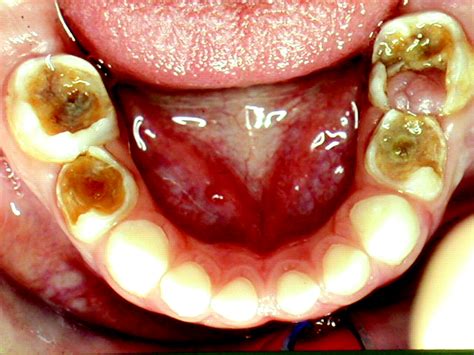 Recognition And Management Of Common Acute Conditions Of The Oral