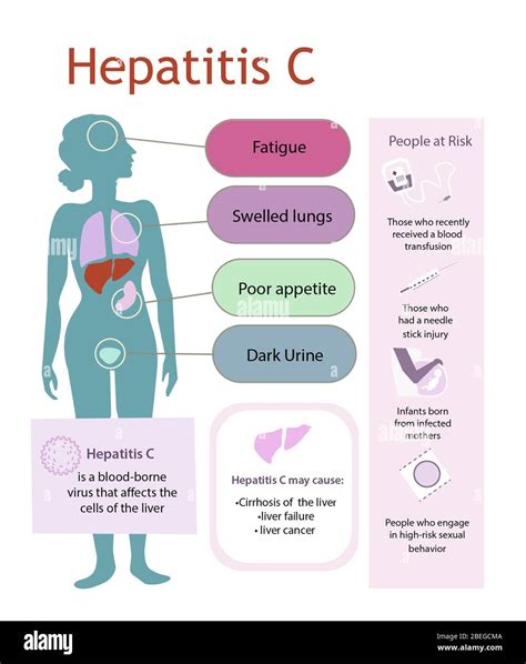 Hepatitis C Diagram Indicating The Effects Of Hepatitis C