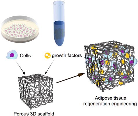 Advances In Biomaterials For Adipose Tissue Reconstruction In Plastic