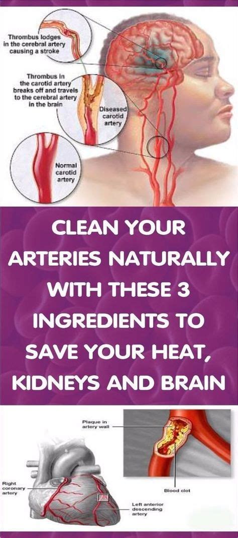 how to clean out arteries 3 ingredients mixture howtoclean clean