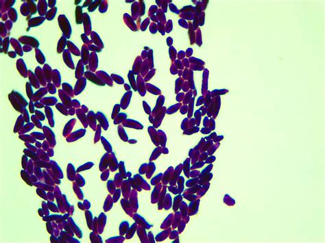 Micrograph Candida Albicans Gram Stain 1000x P000025 Oer Commons