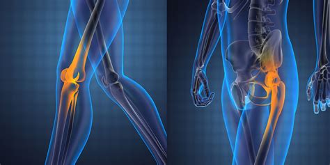 Knee And Hip Replacement Orthopedic Surgeon Monmouth County Nj