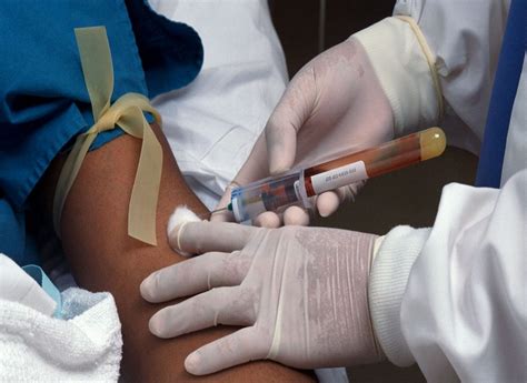 A Guide To Medical Testing Nhs Blood Test Services