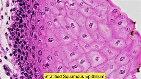 Stratified Squamous Epithelium Is Found Ina Pharynxb Tracheac