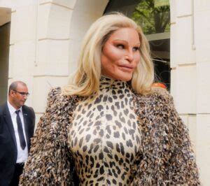 Jocelyn Wildenstein Before And After Plastic Surgery Age And Husband