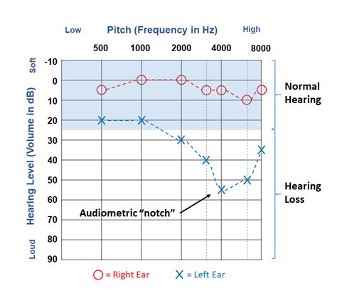overview of hearing loss almostadoctor