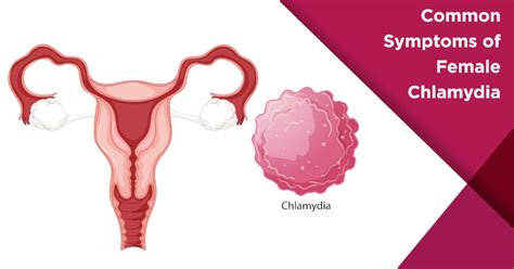 Female Chlamydia Symptoms What You Need To Know Nova Ivf