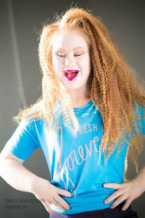 18-Year-Old Model With Down Syndrome Will Walk at New York ...