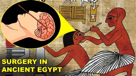 Ever Wondered How Surgery Was Performed In Ancient Egypt Youtube