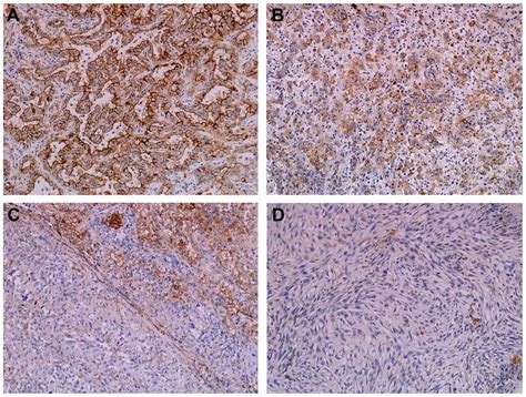 We did not find results for: CD9 expression as a favorable prognostic marker for ...