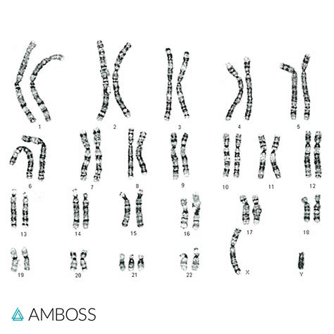 The Karyotype 47 Xy 21 Is Best Described As Being