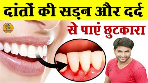 2 मिनट में दांत दर्द ख़त्म घरेलू इलाज Home Remedy For Toothache Dant