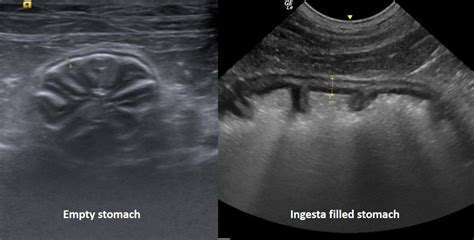 Ultrasonography Gastrointestinal Tract Imv Imaging