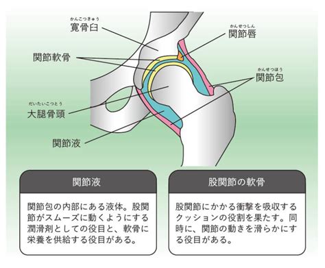 変形性股関節症とはどんな病気？ - 専門医師による関節の痛み ...