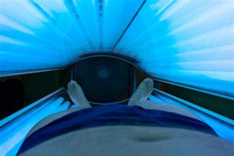 What You Need To Know Before Trying Phototherapy For Severe Eczema