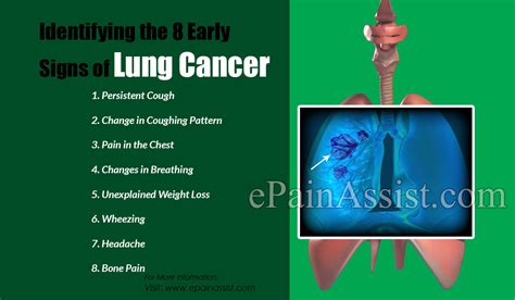 Identifying The 8 Early Signs Of Lung Cancer