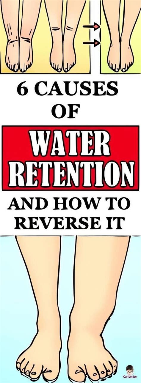 6 Causes Of Water Retention And How To Reverse It In 2020 Water