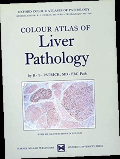 Readdownload Colour Atlas Of Liver Pathology Oxford Color Atlases