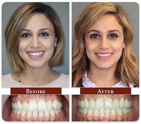 Dental Care Studios Before And After Dental Treatment Patient Photos