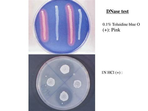 Ppt Pyogenic Coccus Powerpoint Presentation Free Download Id3589406