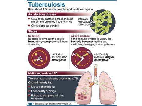 Tuberculosis is generally treatable with. TB stalks Filipinos in California county | Global News