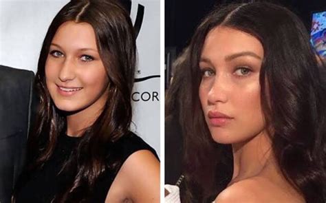 She made some changes of her body. Bella Hadid plastic surgery and modeling