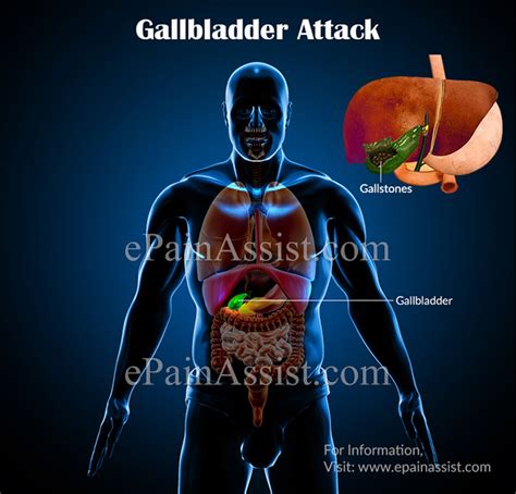 Diagram Diagram Gallbladder Pain Mydiagramonline