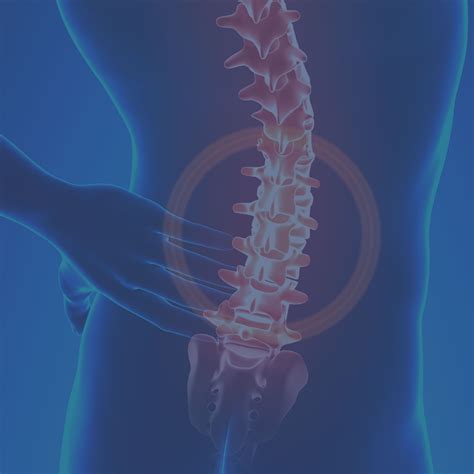 Spinal Disc Degeneration Causes And Treatment Dr Chris Homan