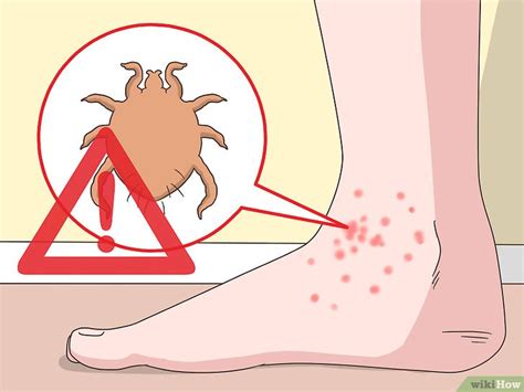 3 Modi per Combattere il Prurito ai Piedi - wikiHow