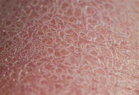Super Macro Texture Of Human Skin Stock Photos Pictures And Royalty Free