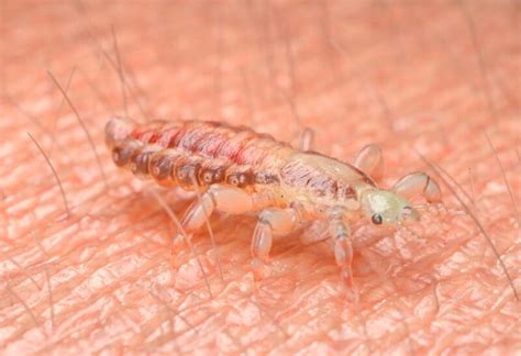 What Causes Lice Infestation All You Need To Know Pest Samurai