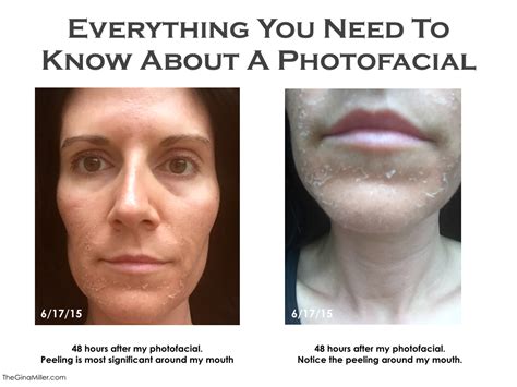 Photofacial Review Everything You Need To Know About This Gamechanging