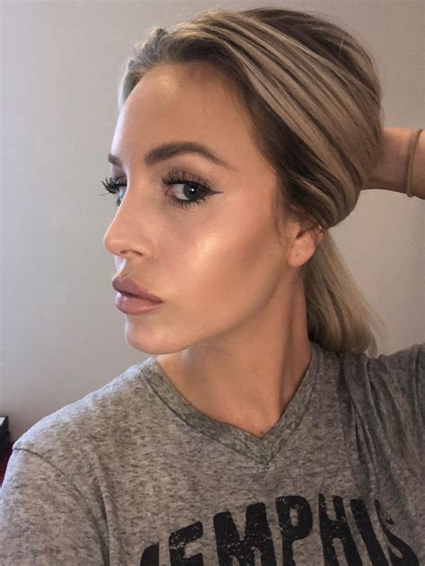 Cheeks, Chin, and Jawline FIllers in San Diego | Skin ...