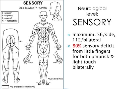 Ppt Case Study Spinal Cord Injury Powerpoint Presentation Free