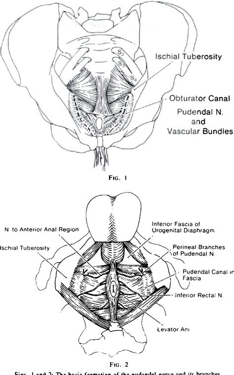 Figure 2 From Pudendal Nerve Palsies Associated With Closed
