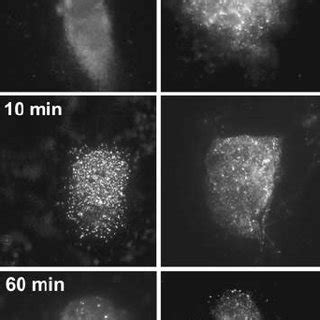 Check out aoa1's art on deviantart. Induction of XRCC1 foci in control and AOA1 cells. NFF and ...