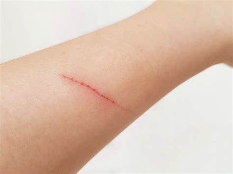 Why Are Cat Scratches Itchy 4 Vet Explained Reasons Hepper