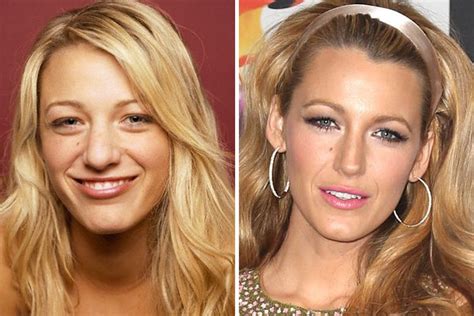 Top 8 Celebrities Who Have Had Cosmetic Surgery Celebrity Plastic