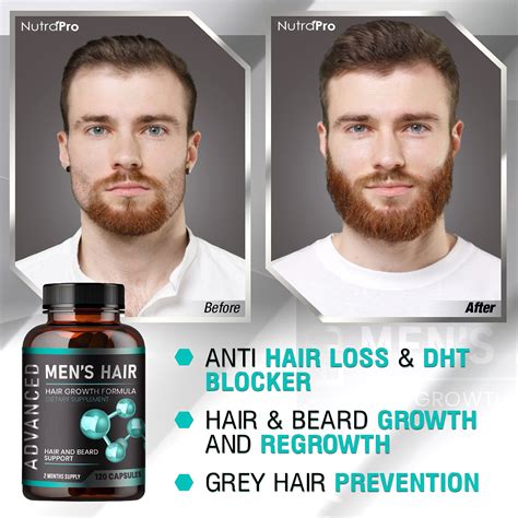 Hair Growth Vitamins For Men Anti Hair Loss Pills Regrow Hair And Beard Growth Supplement For