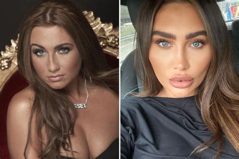 Lauren Goodger S Face Before And After Surgery As Towie Stars Transformations Revealed The