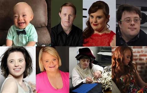 Success In All Shapes Celebrities With Down Syndrome Mind