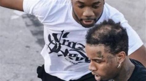 Tory Lanez Roasted After Photos Seemingly Show His Bald Spot Vladtv