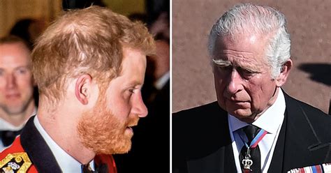 Prince Harrys Hair Loss Isnt Due To Stress Expert Blames Prince Charles