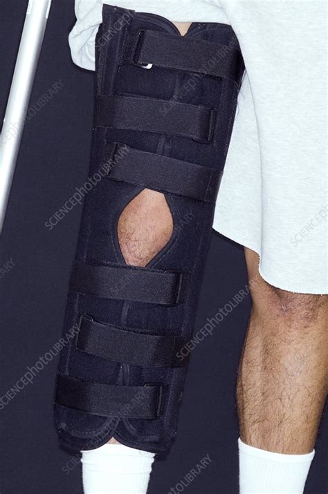 Torn Knee Ligament In Leg Brace Stock Image C0142778 Science