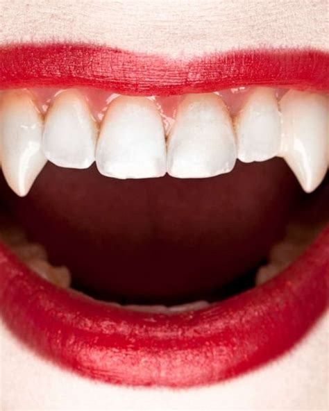 How To Get Vampire Teeth For Real Reverasite