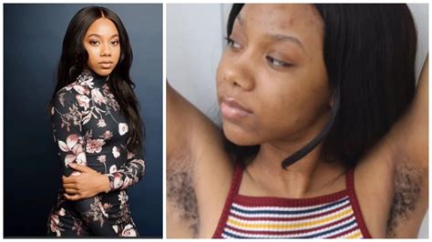Beautiful Woman Says She Is Comfortable With Her Long Armpit Hair